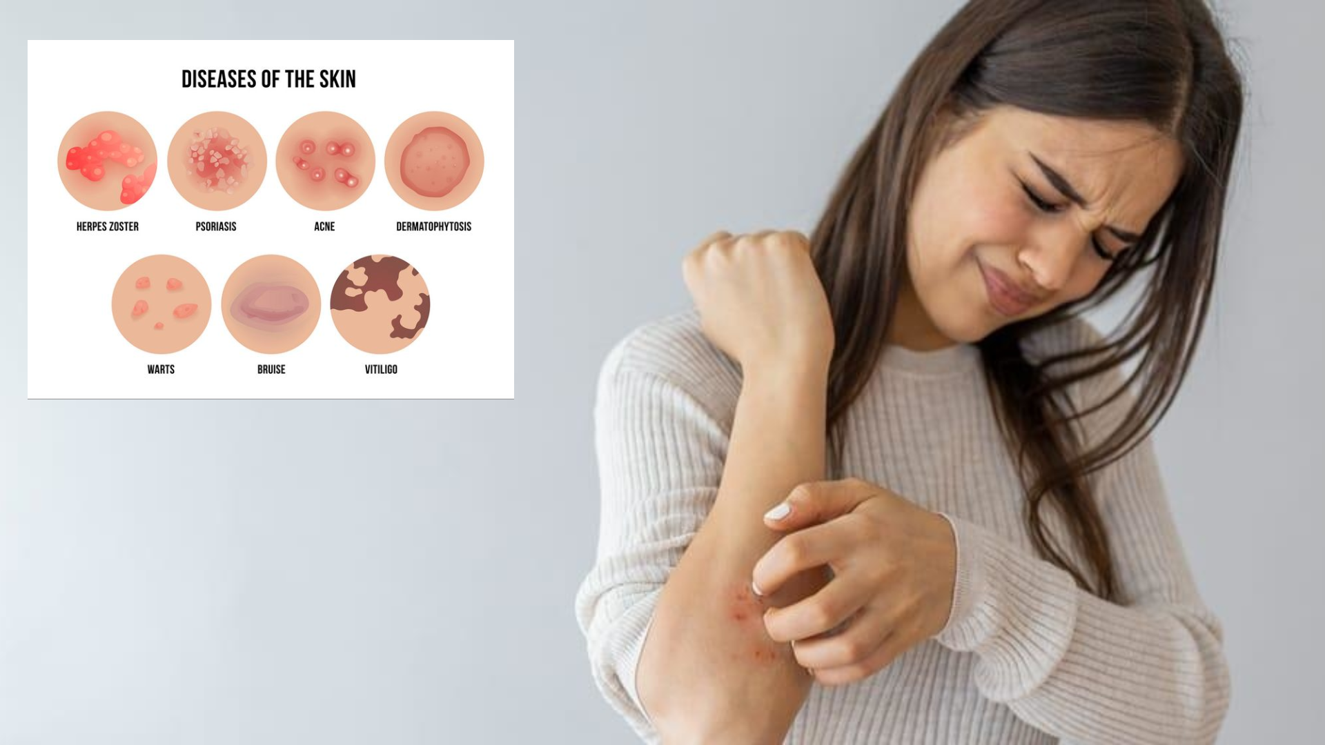 Skin Disease and Rashes